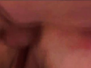 nurse anal fistimg