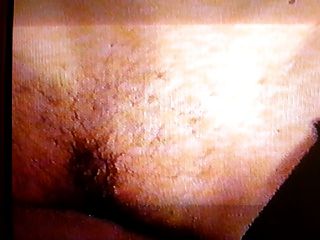 pelosa romana